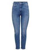 Only Jeans 15283925